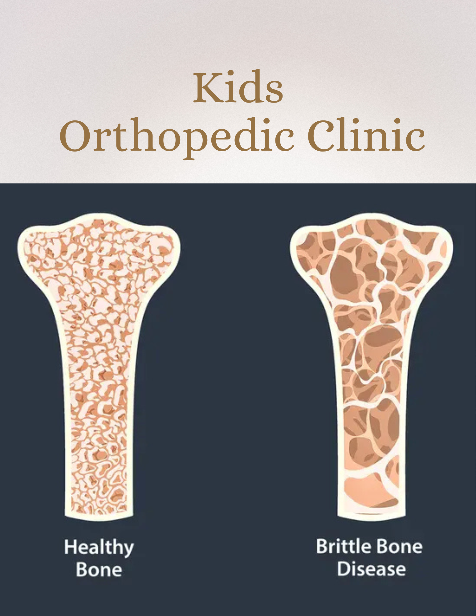Osteogenesis Imperfecta